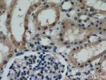 VILIP 3 Antibody in Immunohistochemistry (Paraffin) (IHC (P))