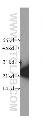 SKP1 Antibody in Western Blot (WB)