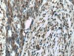 CSNK2A1 Antibody in Immunohistochemistry (Paraffin) (IHC (P))