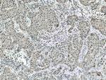 CSNK2A1 Antibody in Immunohistochemistry (Paraffin) (IHC (P))