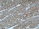 ATP5O Antibody in Immunohistochemistry (Paraffin) (IHC (P))