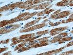 ATP5O Antibody in Immunohistochemistry (Paraffin) (IHC (P))