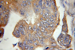POLG2 Antibody in Immunohistochemistry (Paraffin) (IHC (P))