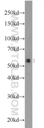 POLG2 Antibody in Western Blot (WB)