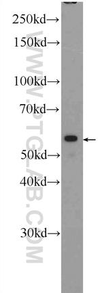 POLG2 Antibody in Western Blot (WB)