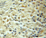 SMARCD1 Antibody in Immunohistochemistry (Paraffin) (IHC (P))