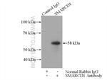 SMARCD1 Antibody in Immunoprecipitation (IP)