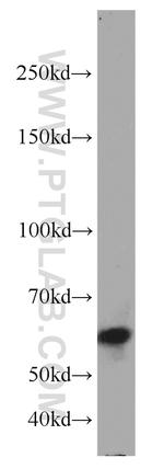 SMARCD1 Antibody in Western Blot (WB)