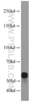 SMARCD1 Antibody in Western Blot (WB)