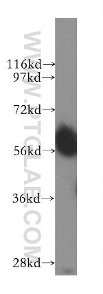 SMARCD1 Antibody in Western Blot (WB)