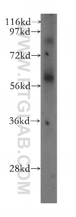 SPATA2 Antibody in Western Blot (WB)