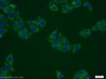 PANK2 Antibody in Immunocytochemistry (ICC/IF)