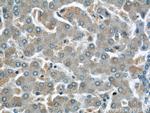 PANK2 Antibody in Immunohistochemistry (Paraffin) (IHC (P))