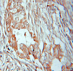 PANK2 Antibody in Immunohistochemistry (Paraffin) (IHC (P))
