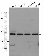 PANK2 Antibody in Western Blot (WB)