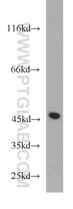 PANK2 Antibody in Western Blot (WB)