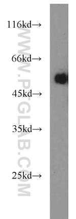PANK2 Antibody in Western Blot (WB)