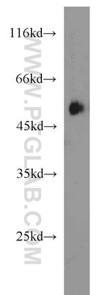 PANK2 Antibody in Western Blot (WB)
