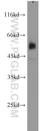 PANK2 Antibody in Western Blot (WB)