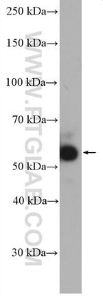 PANK2 Antibody in Western Blot (WB)