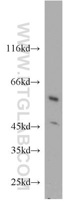 PANK2 Antibody in Western Blot (WB)