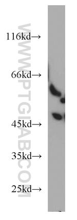 PANK2 Antibody in Western Blot (WB)