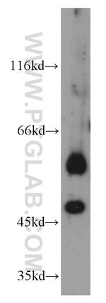 PANK2 Antibody in Western Blot (WB)