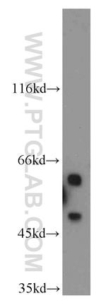 PANK2 Antibody in Western Blot (WB)