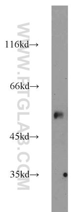 PANK2 Antibody in Western Blot (WB)