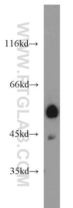 PANK2 Antibody in Western Blot (WB)