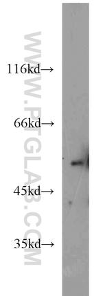 PANK2 Antibody in Western Blot (WB)