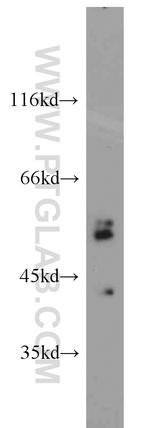 PANK2 Antibody in Western Blot (WB)