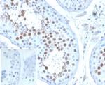 KIF2C (Kinesin Family Member 2C)/MCAK Antibody in Immunohistochemistry (Paraffin) (IHC (P))