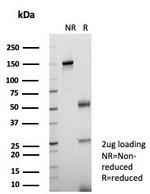 KIF2C (Kinesin Family Member 2C)/MCAK Antibody in SDS-PAGE (SDS-PAGE)