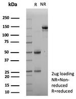 KIF2C (Kinesin Family Member 2C)/MCAK Antibody in SDS-PAGE (SDS-PAGE)