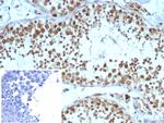 KIF2C (Kinesin Family Member 2C)/MCAK Antibody in Immunohistochemistry (Paraffin) (IHC (P))