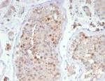 KIF2C (Kinesin Family Member 2C)/MCAK Antibody in Immunohistochemistry (Paraffin) (IHC (P))