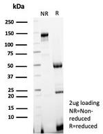 KIF2C (Kinesin Family Member 2C)/MCAK Antibody in SDS-PAGE (SDS-PAGE)