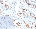 KIF2C (Kinesin Family Member 2C)/MCAK Antibody in Immunohistochemistry (Paraffin) (IHC (P))