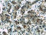 RPL3 Antibody in Immunohistochemistry (Paraffin) (IHC (P))