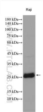 WBS15/LAT2 Antibody in Western Blot (WB)