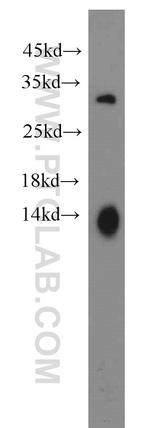 WBS15/LAT2 Antibody in Western Blot (WB)