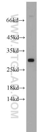 WBS15/LAT2 Antibody in Western Blot (WB)