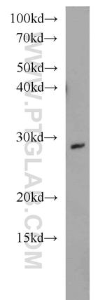 WBS15/LAT2 Antibody in Western Blot (WB)