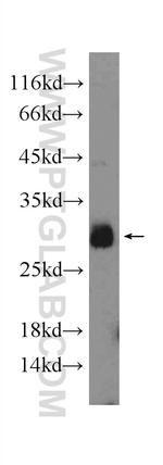WBS15/LAT2 Antibody in Western Blot (WB)