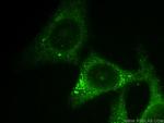 Midkine Antibody in Immunocytochemistry (ICC/IF)