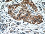 Midkine Antibody in Immunohistochemistry (Paraffin) (IHC (P))