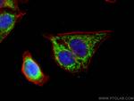 AK2 Antibody in Immunocytochemistry (ICC/IF)