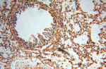 AK2 Antibody in Immunohistochemistry (Paraffin) (IHC (P))