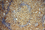 AK2 Antibody in Immunohistochemistry (Paraffin) (IHC (P))